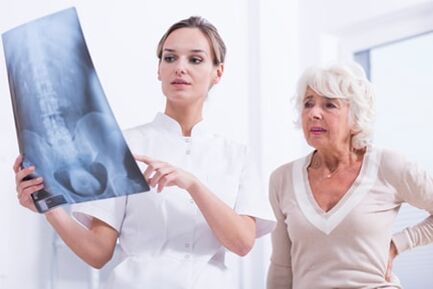 Medicul arată pacientului o imagine X -Ray a coloanei vertebrale