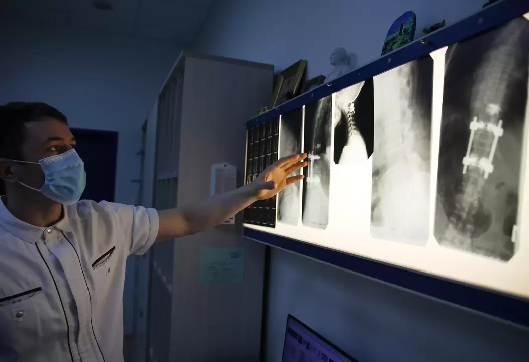 Medicii diagnostichează osteocondroza cervicală folosind metode instrumentale, cum ar fi radiografia